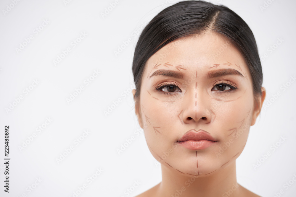 Face of beautiful young Vietnamese woman with lines for upcoming surgery Face of beautiful young Vietnamese woman with lines for upcoming surgery