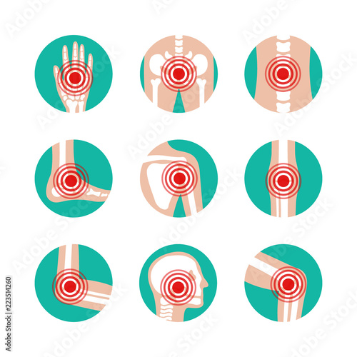 Vector set of human joints with pain rings. Disease in bone, knee, leg, pelvis, scapula, skull, elbow, foot and hand illustration. Arthritis and rheumatism icons.