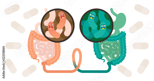 Fecal microbiota transplant (FMT) or stool transplant procedure concept