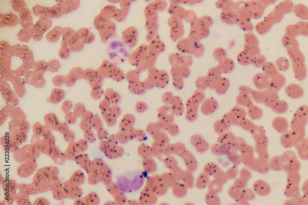 Study of white blood cells are the cells of the immune system under the microscope in laboratories. Study of white blood cells are the cells of the immune system under the microscope in laboratories.