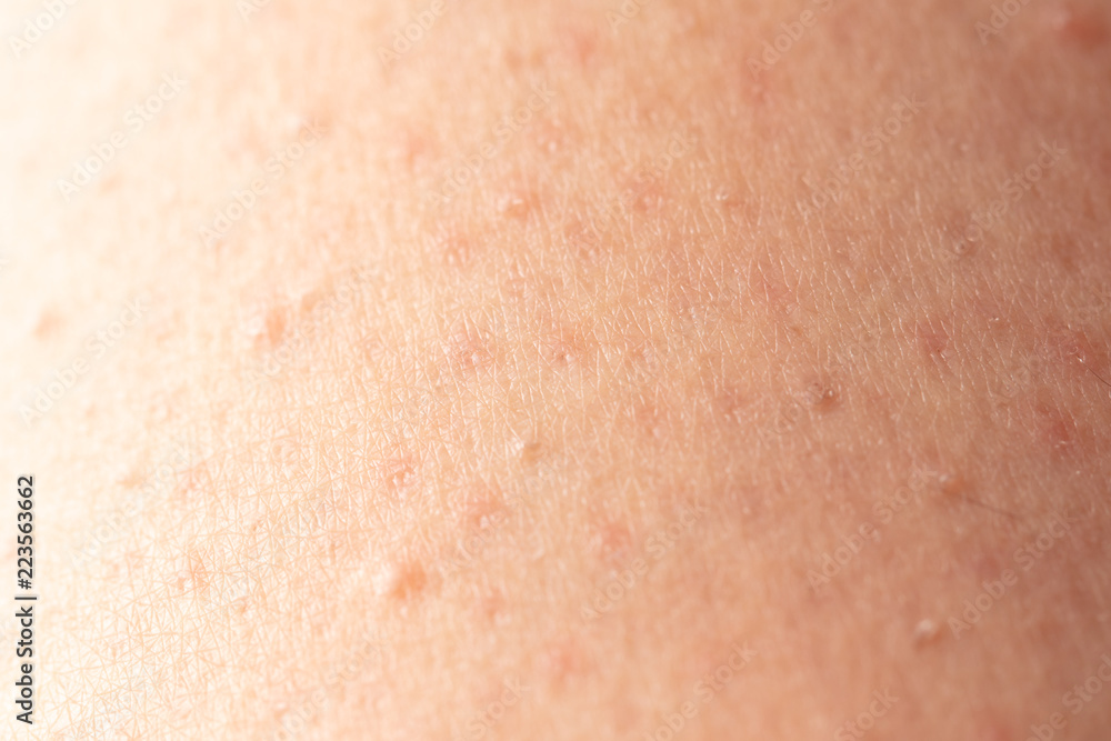 Fototapeta premium Girl's skin after depilation as a background