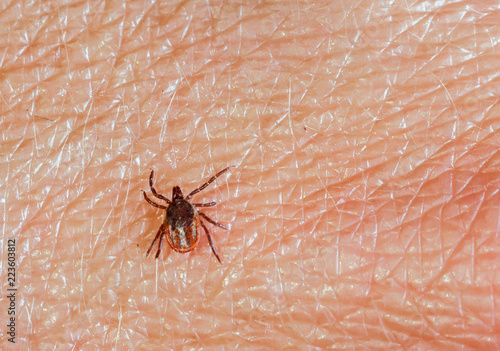 A predatory tick crawls along the human skin. Closeup, top view. © vladk213