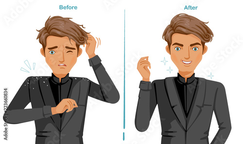 Dandruff on the shoulders. man In black suit. difference of Scalp problem and good skins of hair health. Feeling happy  and satisfied. Illustrations for products. Vector isolated on white background.