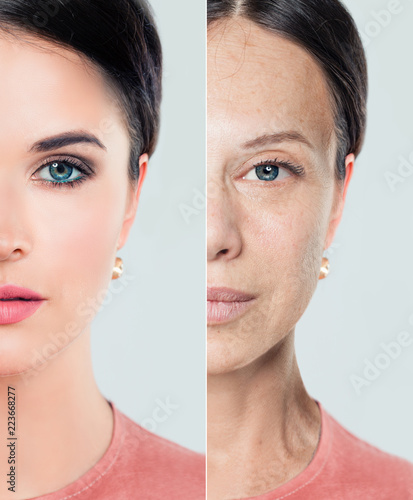 Perfect female face with problem and clean skin, beauty treatment and lifting. Before and after, youth and old age. Aging and youth woman. Process of aging and rejuvenation