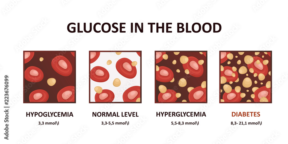 Glucose levels in the blood diagram hyperglycemia, hypoglycemia