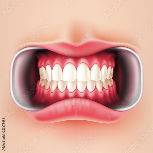 Vector dental braces, oral brakets system 3d