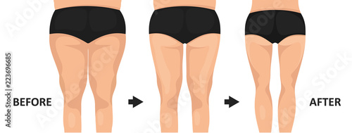 Fatty ass before and after losing weight. Back view.