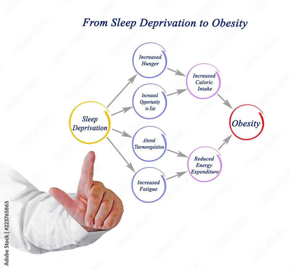 From Sleep Deprivation to Obesity . From Sleep Deprivation to Obesity .