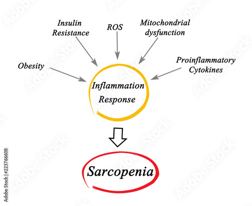 Causes of Sarcopenia. photo