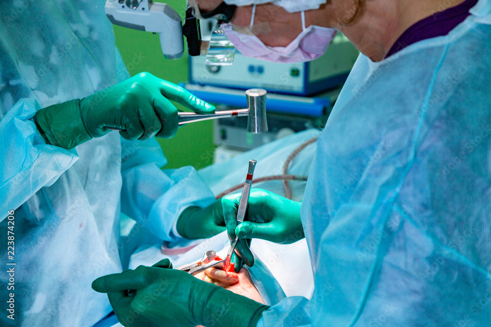 Surgeon and his assistant performing cosmetic surgery on nose in hospital operating room. Nose reshaping, augmentation. Rhinoplasty. Surgeon and his assistant performing cosmetic surgery on nose in hospital operating room. Nose reshaping, augmentation. Rhinoplasty.