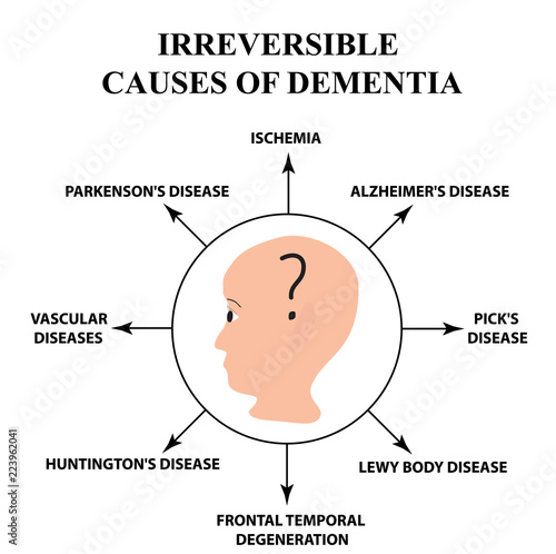 Irreversible causes of senile dementia. Alzheimer's disease. Infographics. Vector illustration on isolated background