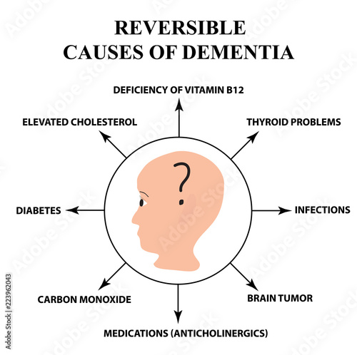 Reversible causes of senile dementia. Alzheimer's disease. Infographics. Vector illustration on isolated background