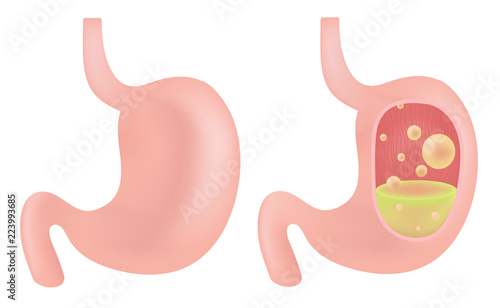 stomach photo