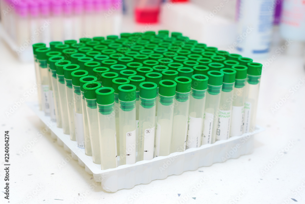 empty blood testing tube in laboratory empty blood testing tube in laboratory