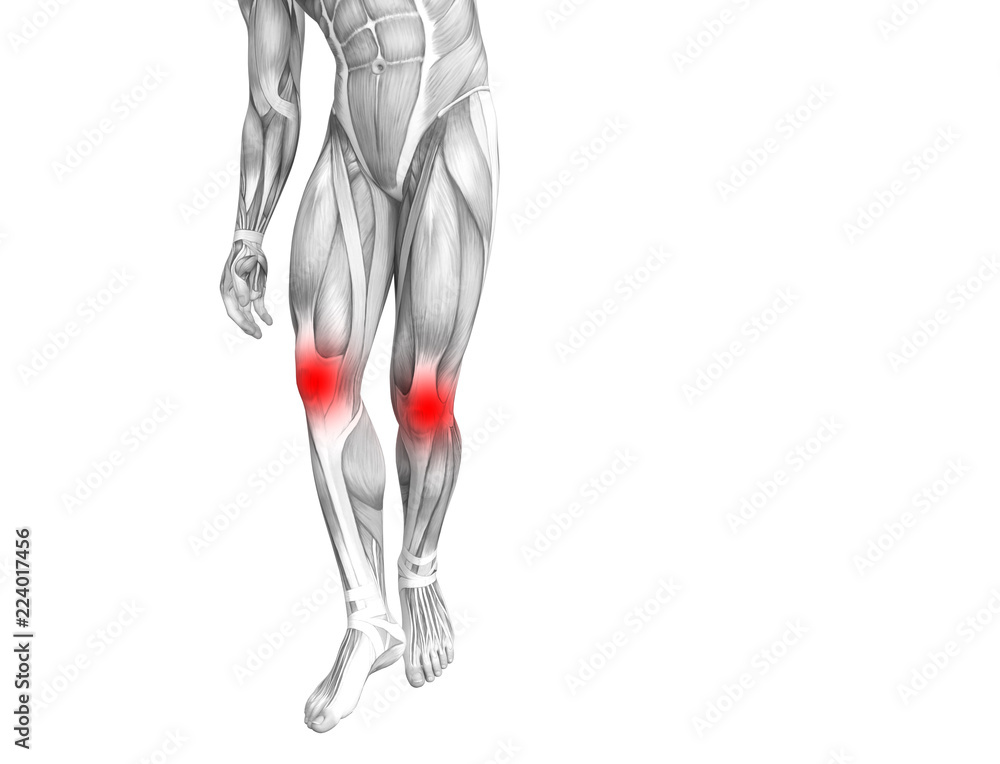 Conceptual knee human anatomy with red hot spot inflammation or articular joint pain for leg health care therapy or sport muscle concepts. 3D illustration man arthritis or bone osteoporosis disease Conceptual knee human anatomy with red hot spot inflammation or articular joint pain for leg health care therapy or sport muscle concepts. 3D illustration man arthritis or bone osteoporosis disease