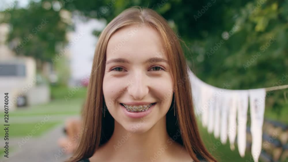 A happy smiling woman wearing braces on her teeth in the city street. Close-up shot. Soft focus A happy smiling woman wearing braces on her teeth in the city street. Close-up shot. Soft focus