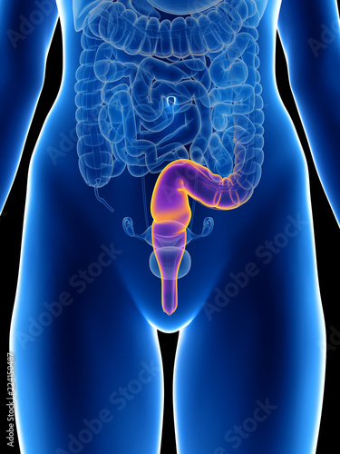 3d rendered medically accurate illustration of a womans rectum photo