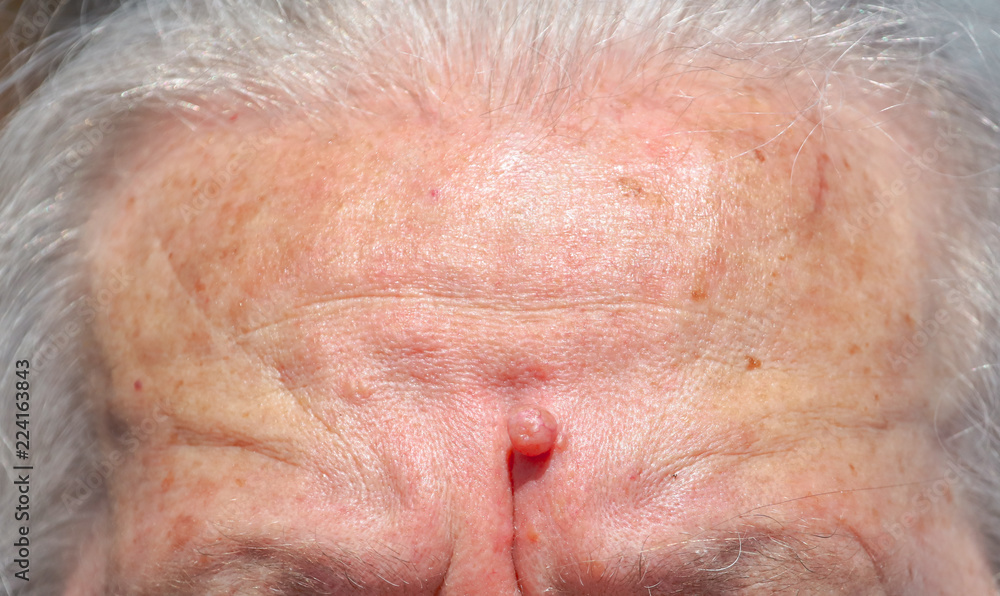 Forehead of an old grandmother as a background Forehead of an old grandmother as a background