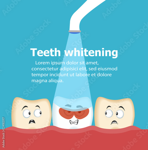 Professional teeth whitening vector illustration