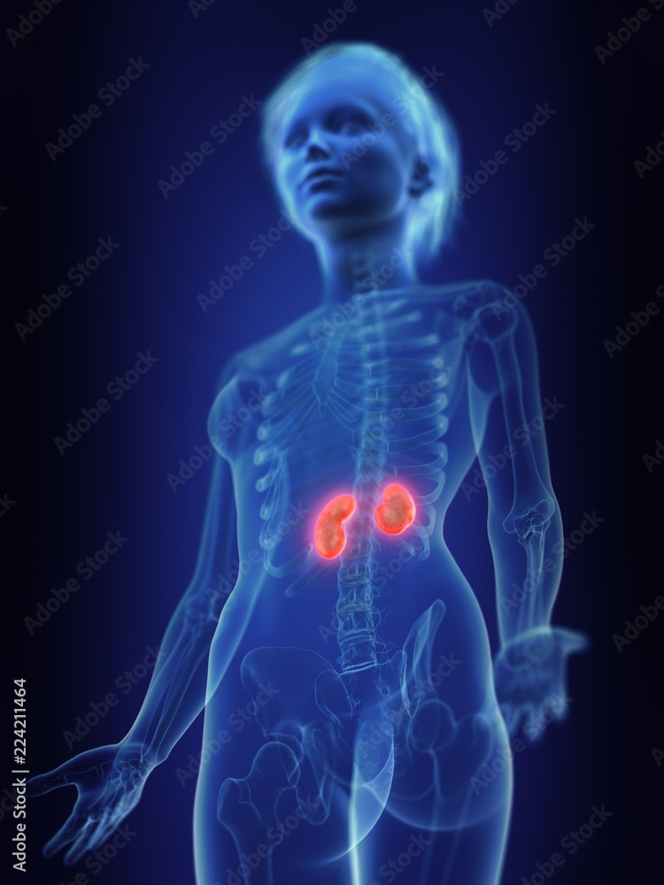 3d rendered medically accurate illustration of an inflamed kidneys 3d rendered medically accurate illustration of an inflamed kidneys