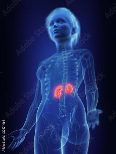 3d rendered medically accurate illustration of an inflamed kidneys
