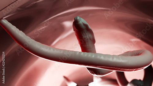 3d rendered illustration of a roundworm in a human colon photo