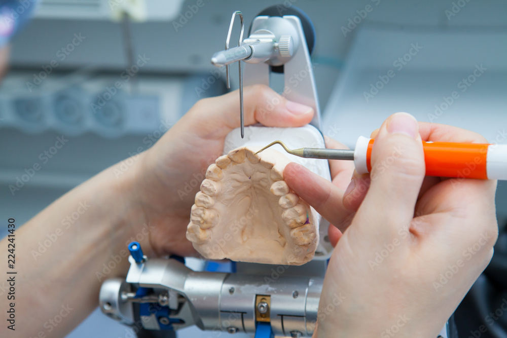 Dentist-dentist working with prostheses in laboratory with wax on jaw model in articulator
