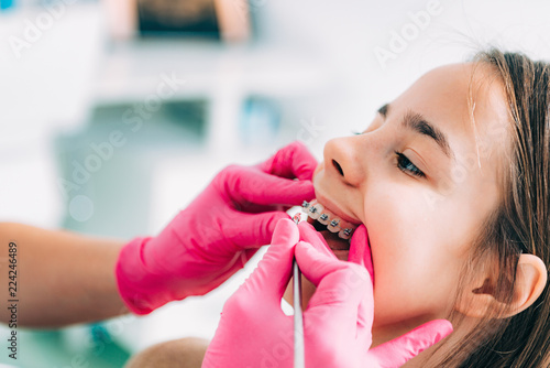 Fototapeta Naklejka Na Ścianę i Meble -  Orthodontist checking girl’s dental braces