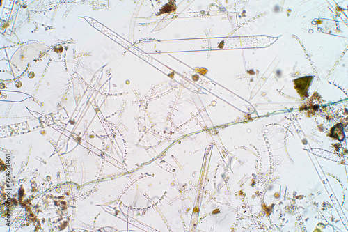 Marine aquatic plankton under microscope view photo