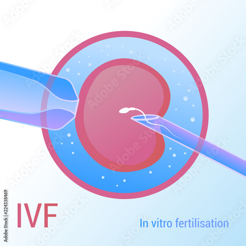 IVF. Artificial insemination. Realistic vector design 3d