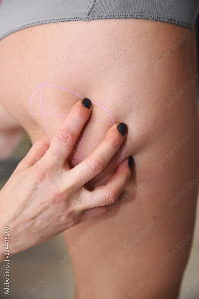 Beauty injections in the salon. The procedure for skin tightening and rejuvenation. Beauty injections in the salon. The procedure for skin tightening and rejuvenation.