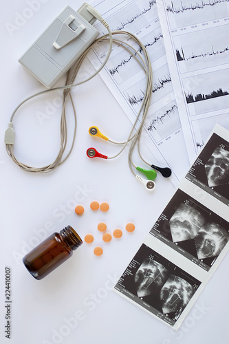 Device of holter monitoring and pills on white background. The concept of diagnosis and treatment of cardiovascular diseases.