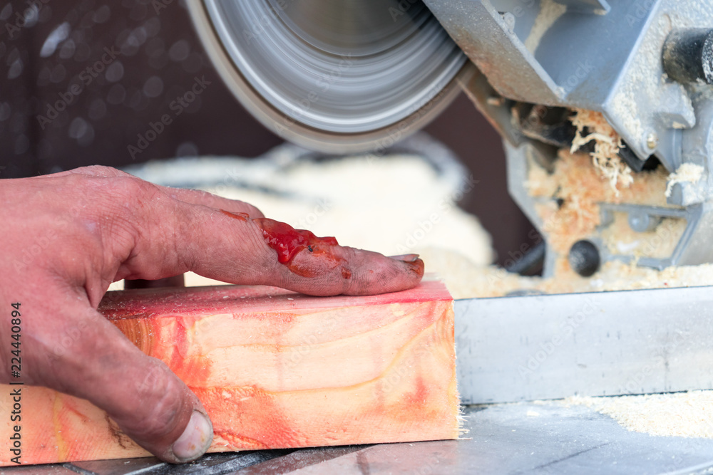 Injury when working with a saw. Place for your text. Injury when working with a saw. Place for your text.