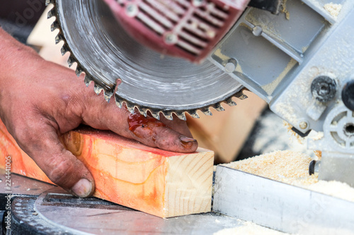 Injury when working with a saw. Place for your text.