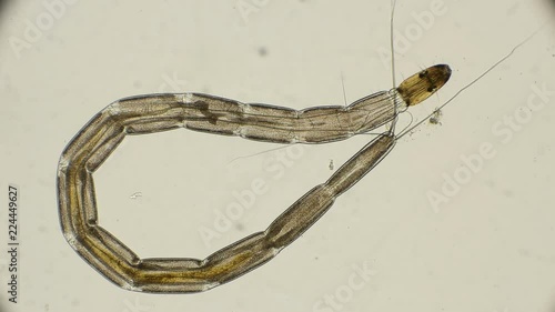 larva biting midges of the family Keratopogonidae under a microscope photo