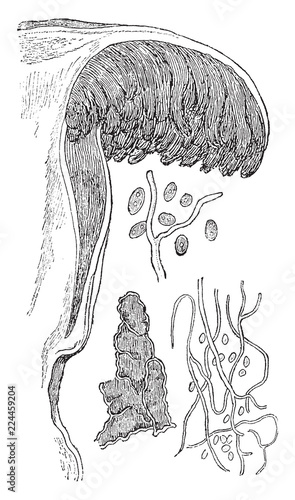 Flocci and Spores vintage illustration.