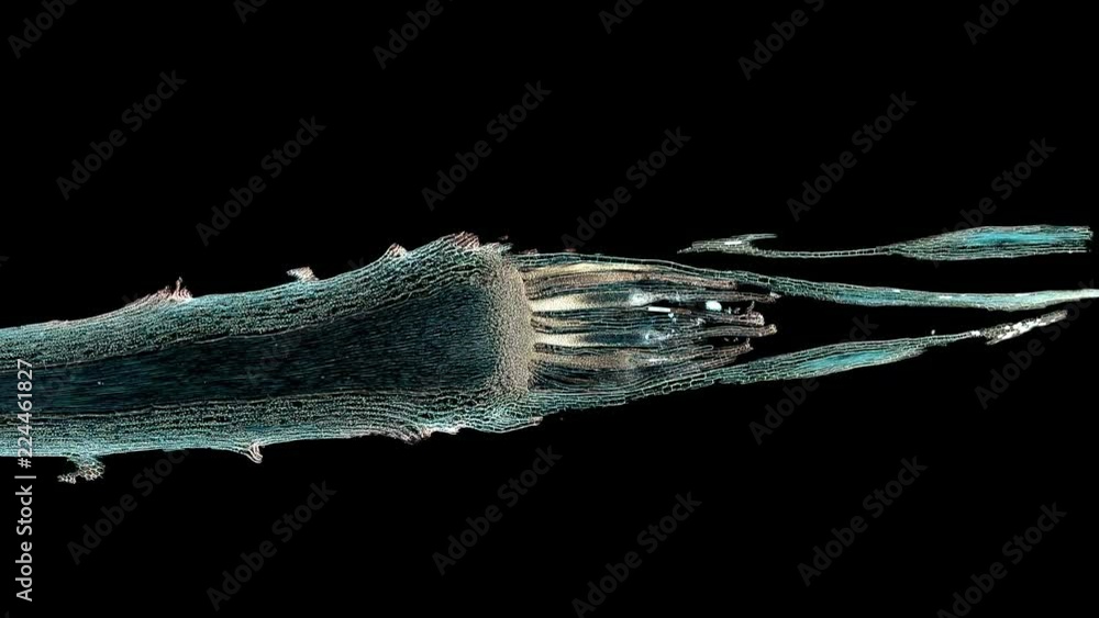 moss archegonium - cross section cut under the microscope – microscopic