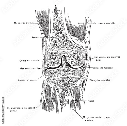Median Frontal Section Through Knee, vintage illustration.