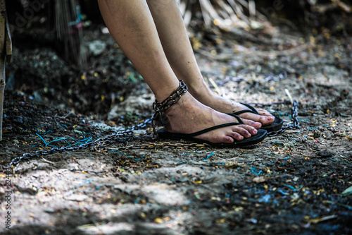 Foot injury of women with vein edema involves hanging metal chains near the ground. © Pongvit