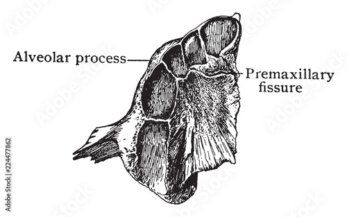 Inferior Surface of Upper Jaw at Birth, vintage illustration.