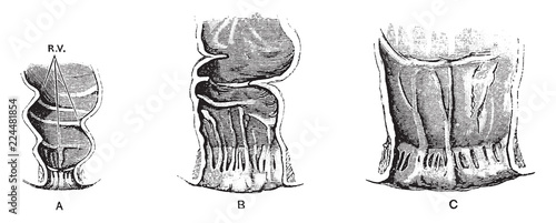 Rectum and Anal Canal in Fetus, vintage illustration.