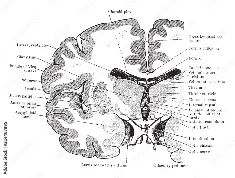 Coronal Section Of Brain Drawing