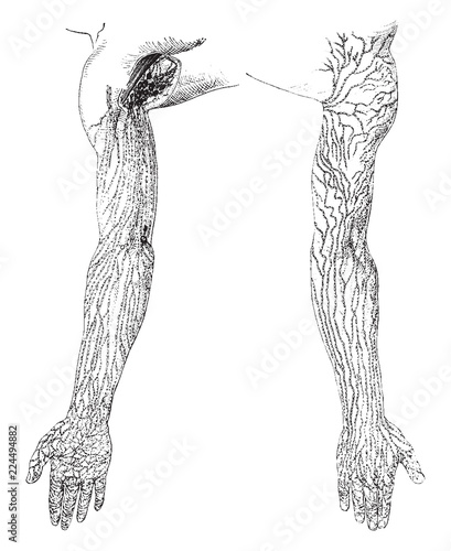 Lymphatic Vessels and Nodes of the Arms, vintage illustration.