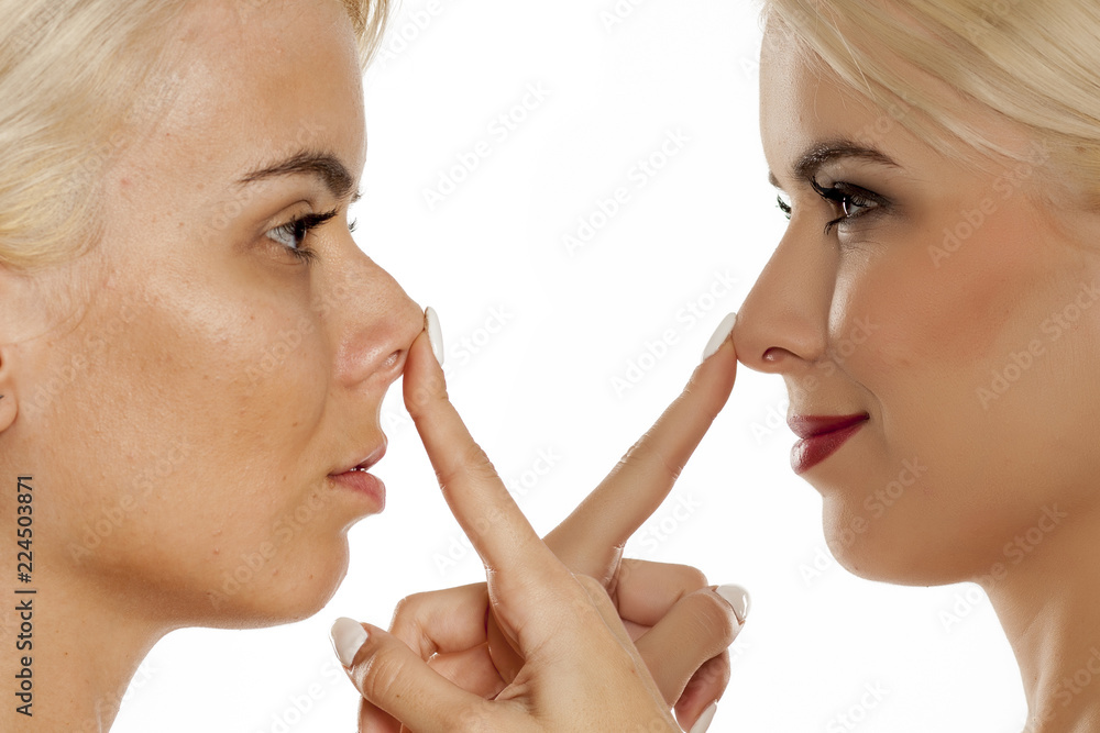 comparative portrait of young blonde woman before and after rinoplasty on white background comparative portrait of young blonde woman before and after rinoplasty on white background