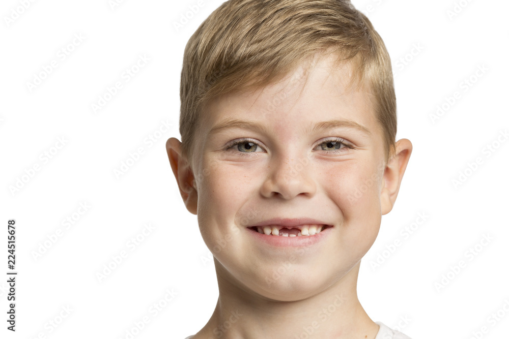 Cute little boy without anterior teeth laughing, close-up Cute little boy without anterior teeth laughing, close-up