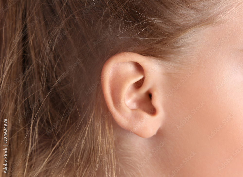 Cute little girl with hearing problem, closeup Cute little girl with hearing problem, closeup