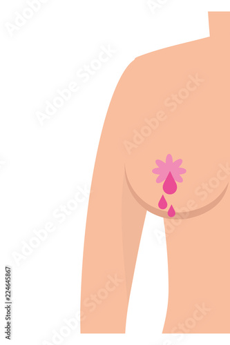Breast cancer sign