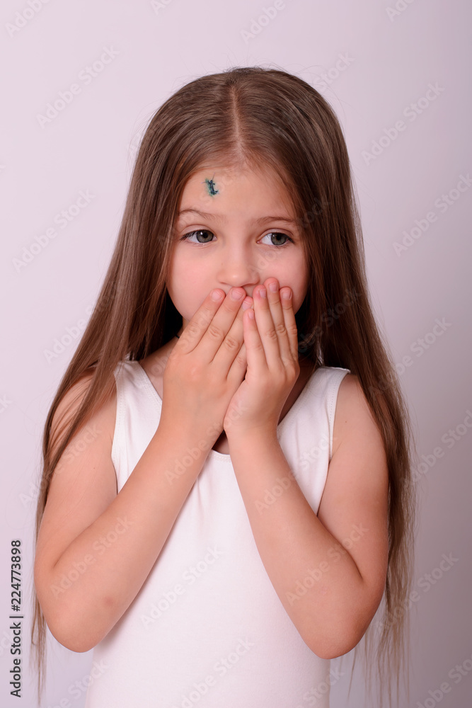 Physical injury blood wound skin human child pain. Little caucasian girl with scar and greener on the forehead. Stitches on the face. Physical injury blood wound skin human child pain. Little caucasian girl with scar and greener on the forehead. Stitches on the face.