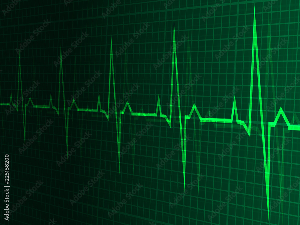 heart rate, heartbeat, neon line, green graphic background. In perspective. Realistic style. Vector illustration.