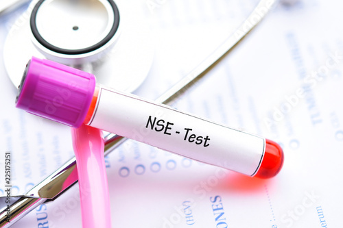 Blood sample tube for Neuron-Specific Enolase or NSE test, tumor marker for lung cancer
 photo